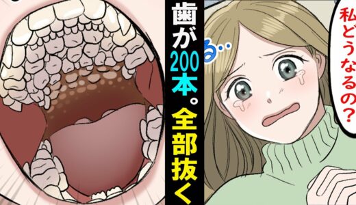 【漫画】歯が200本も生えて来た女。全部抜く事になったがどうしてこんな事に･･。